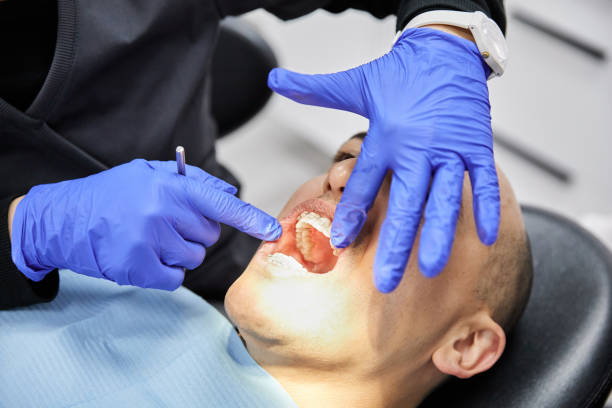 Best Chipped Tooth Repair Near Me  in Grinnell, IA